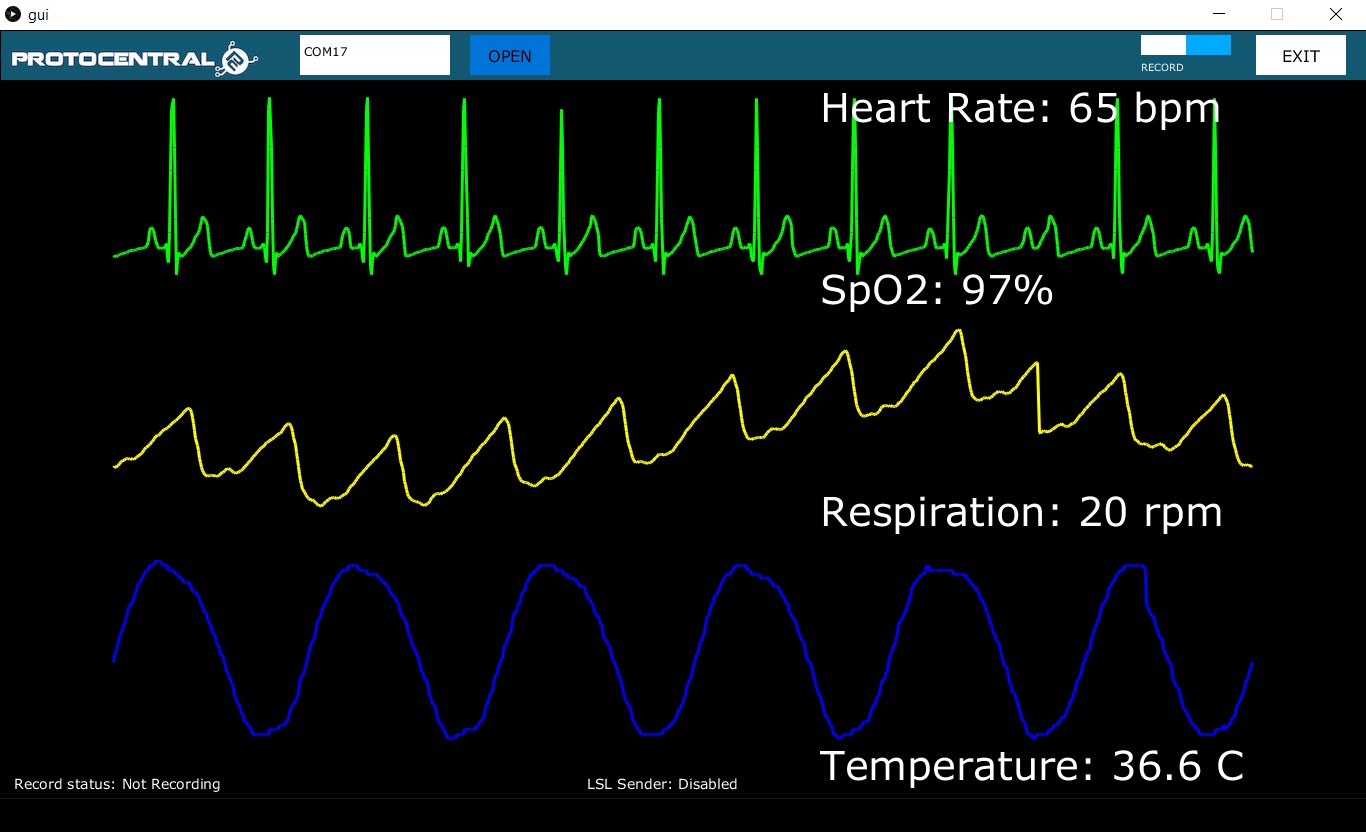 Maxim Announces Wearable ECG and Heart Monitor Development Kits - CNX  Software